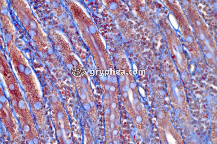 Duodenum x100 - gryphea.org